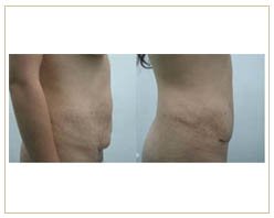 Slider image (7) Roura DermSurgery